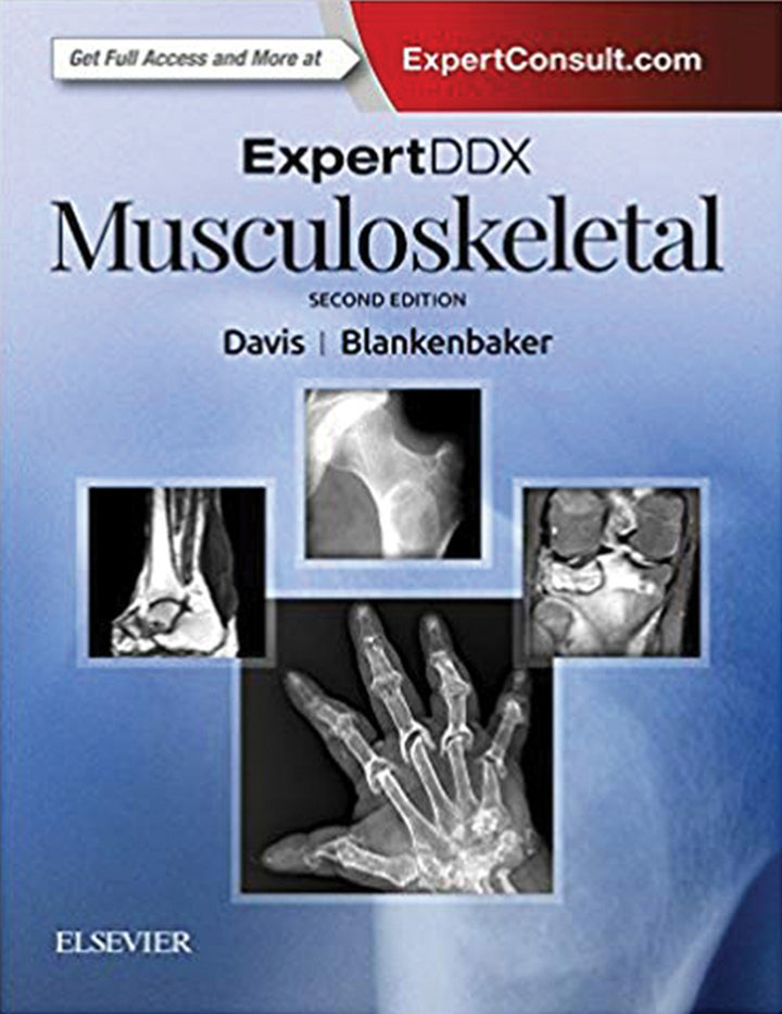 ExpertDDx: Musculoskeletal E-Book 2nd Edition
