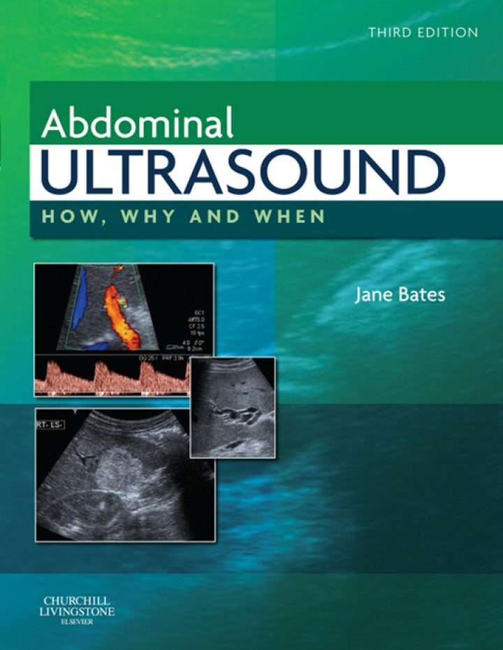 Abdominal Ultrasound: How, Why and When 3rd Edition