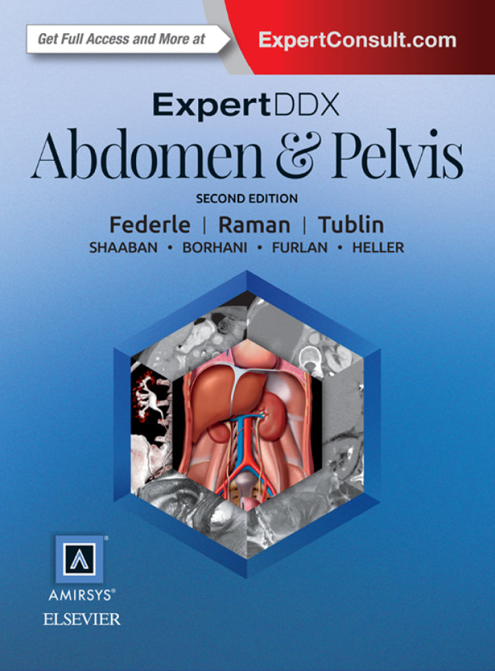 ExpertDDx: Abdomen and Pelvis E-Book 2nd Edition
