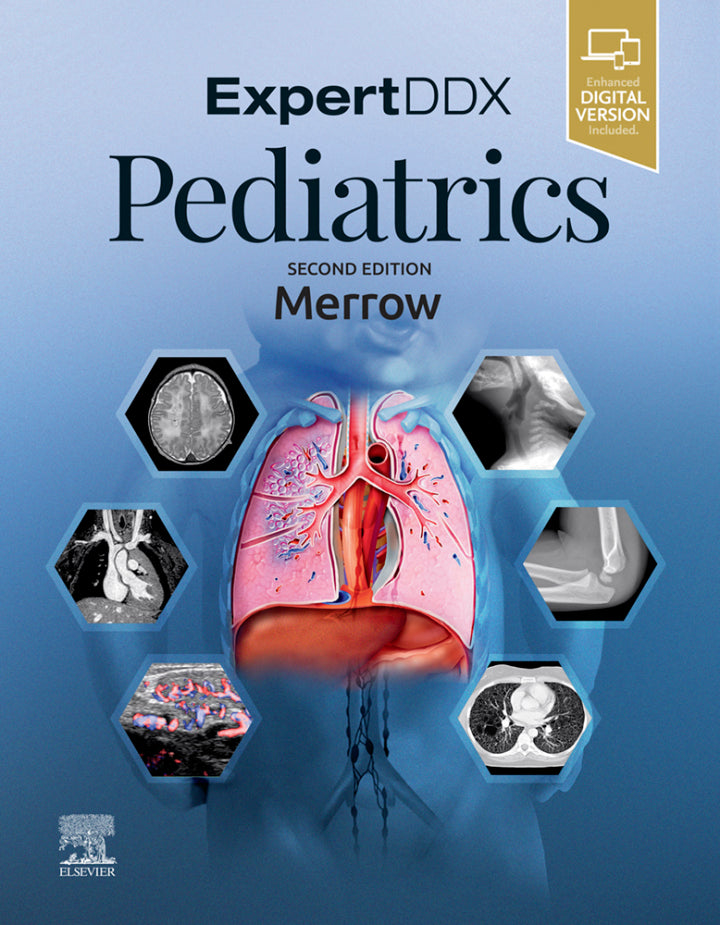 EXPERTddx: Pediatrics 2nd Edition